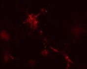 Mouse leukaemic monocyte macrophage cells treated with vinblastine for 1 hr. ATG12 antibody detected punctuate staining indicative of nascent autophagic vacuole structures.