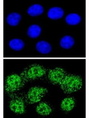 MSH2 Antibody for IF / MSH2 Immunofluorescence Antibody. Confocal immunofluorescence analysis of MSH2 Antibody for IF in human HeLa cells. MutS homolog 2 / MSH2 is visualized using Alexa Fluor 488-conjugated goat anti-rabbit IgG (green), showing strong nuclear fluorescence with a punctate and granular distribution consistent with localization of the MSH2 DNA mismatch repair protein within the nucleus. The top panel shows DAPI nuclear staining (blue), while the lower panel highlights MSH2 immunofluorescent signal concentrated within the nuclei of individual cells. This staining pattern reflects the expected nuclear localization of MSH2 in actively proliferating cells.