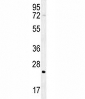 H-RAS antibody western blot analysis in mouse cerebellum tissue lysate. Predicted molecular weight ~ 21 kDa.