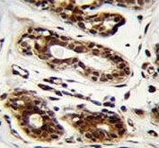 Nucleolin antibody immunohistochemistry analysis in formalin fixed and paraffin embedded human breast tissue.