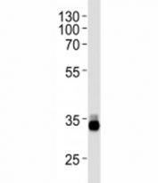 OTX2 antibody western blot analysis in Y79 lysate