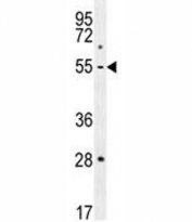 Fibroblast Collagenase Antibody MDA-MB231 Cell WB. Western blot analysis of MDA-MB231 human breast cancer cell lysate using Fibroblast Collagenase Antibody. A specific band is detected at approximately 54 kDa, consistent with the expected molecular weight of the MMP1 proenzyme (pro-MMP1). Detection in the highly invasive MDA-MB231 cell line supports the use of Fibroblast Collagenase Antibody for studying MMP1 expression, collagen degradation and cancer-associated extracellular matrix remodeling.