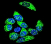 Confocal immunofluorescent analysis of WT1 antibody with MCF-7 cells followed by Alexa Fluor 488-conjugated goat anti-rabbit lgG (green). DAPI was used to stain the nuclei (blue).