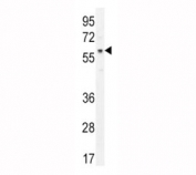AKT antibody western blot analysis in MCF-7 lysate