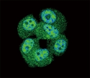 Confocal immunofluorescent analysis of AKT antibody with MCF-7 cells followed by Alexa Fluor 488-conjugated goat anti-rabbit lgG (green). DAPI was used as a nuclear counterstain (blue).