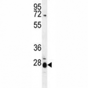 IL17B Antibody Mouse Spleen WB. Western blot analysis of IL17B expression in mouse spleen tissue lysate using an IL17B antibody. IL17B, also known as Interleukin 17B, is a secreted cytokine involved in inflammatory signaling and innate immune regulation. A distinct band is detected at approximately 28 kDa. Although the predicted molecular weight of IL17B is approximately 17 to 20 kDa depending on glycosylation, the higher apparent molecular weight observed here may reflect extensive glycosylation, dimerization, or other post translational modifications that influence electrophoretic mobility. These results support the utility of IL17B Antibody for studies of cytokine signaling, inflammation, and immune responses.
