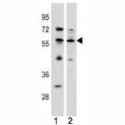 KLF4 antibody western blot analysis in (1) MCF-7 (2) K562 lysate. Predicted molecular weight: 50-60 kDa + possible ~75 kDa (phosphorylated form).