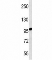 STIM2 antibody western blot analysis in uterus tumor lysate. Predicted molecular weight: 84/94/68 kDa (isoforms 1/2/3).