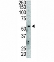 Western blot analysis of anti-MDM2 antibody and mouse lung tissue lysate. Predicted molecular weight: ~55 kDa but can be observed at up to ~90 kDa.