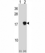 Western blot analysis of SUMO4 antibody and 293 cell lysate either nontransfected (Lane 1) or transiently transfected (2) with the SUMO4 gene.
