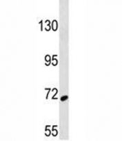 SYK antibody western blot analysis in 293 lysate