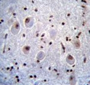 Anti-PAX6 antibody immunohistochemistry analysis in formalin fixed and paraffin embedded human brain tissue