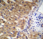 MUC15 antibody immunohistochemistry analysis in formalin fixed and paraffin embedded human liver tissue.