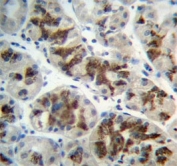 IHC analysis of FFPE human stomach and CTGF antibody