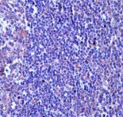 TUBA4A antibody immunohistochemistry analysis in formalin fixed and paraffin embedded human tonsil tissue.