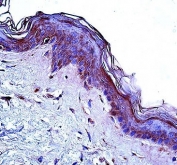 CD1A antibody immunohistochemistry analysis in formalin fixed and paraffin embedded human skin tissue.