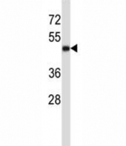 CD1A Antibody for WB. Western blot analysis of CD1A / CD1a protein expression in MDA-MB231 cell lysate using CD1A Antibody for WB. Lane 1: MDA-MB231 lysate. A band is detected at approximately 45-50 kDa, consistent with the predicted molecular weight of CD1A / CD1a (37-49 kDa). The slightly higher apparent molecular weight is consistent with glycosylation of this membrane-associated protein, which can shift migration on SDS-PAGE.