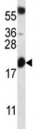 BCL2 antibody western blot analysis in mouse heart tissue lysate