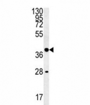 WNT8B Antibody K562 WB. Western blot analysis of human K562 cell lysate using WNT8B antibody demonstrates a distinct immunoreactive band at approximately 39 kDa, consistent with the predicted molecular weight of WNT8B. WNT8B is a secreted Wnt family signaling ligand that participates in developmental signaling pathways regulating cell fate determination, tissue patterning, differentiation, and cellular communication. As an upstream activator of Wnt signaling cascades, WNT8B influences transcriptional programs involved in embryogenesis and maintenance of tissue organization. The observed band supports expression of WNT8B in K562 cells and demonstrates the utility of this antibody for western blot analysis of Wnt pathway-associated proteins. Predicted molecular weight: ~39 kDa.