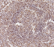 CD163L1 Antibody Human Spleen IHC. Immunohistochemistry staining of FFPE human spleen tissue using CD163L1 antibody demonstrates widespread cytoplasmic and membranous HRP-DAB brown staining throughout densely packed immune cell populations within the splenic white pulp. The staining pattern is consistent with expression of CD163 Like 1 / CD163L1, a scavenger receptor family protein associated with monocyte-macrophage lineage cells and innate immune regulation. Robust staining within lymphoid-rich regions supports the utility of CD163L1 as a marker for studies of immune cell specialization, macrophage-associated biology, and maintenance of splenic immune homeostasis. HIER: boil tissue sections in pH 9 10mM Tris with 1mM EDTA for 20 min and allow to cool before testing.