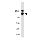 CD163L1 Antibody U-2 OS WB. Western blot analysis of human U-2 OS cell lysate using CD163L1 antibody detects a prominent band at approximately 160-180 kDa, consistent with CD163 Like 1 / CD163L1. The observed molecular weight is higher than the calculated molecular weight predicted from the amino acid sequence, which is expected for heavily glycosylated scavenger receptor family proteins. CD163L1 is a transmembrane scavenger receptor cysteine-rich family member associated with monocyte-macrophage biology, innate immune regulation, and receptor-mediated cellular interactions. The detected signal supports expression of CD163L1 in U-2 OS cells and is consistent with the migration characteristics reported for glycosylated cell-surface receptors.