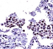 Anti-TLR8 antibody immunohistochemistry analysis in formalin fixed and paraffin embedded human lung tissue