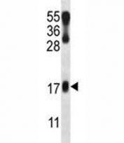 LMO2 antibody western blot analysis in NCI-H460 lysate.