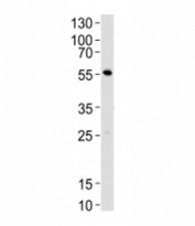 Lck Antibody Mouse Thymus WB. Western blot analysis of mouse thymus tissue lysate using Lck antibody at 1:1000. Predicted molecular weight ~58 kDa.