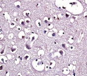 Lipoprotein Lipase Antibody Human Brain IHC. Immunohistochemical staining of formalin-fixed, paraffin-embedded human brain tissue using Lipoprotein Lipase Antibody demonstrates cytoplasmic HRP-DAB brown staining within scattered neural cell populations against a background of neuropil-rich tissue architecture. The staining pattern is consistent with expression of Lipoprotein Lipase (LPL), a key enzyme involved in triglyceride hydrolysis, fatty acid mobilization, and lipid utilization. LPL contributes to lipid processing pathways that support cellular energy balance and membrane maintenance, processes that are particularly important in metabolically active tissues. The observed staining supports the role of LPL in regulating lipid availability and fatty acid utilization within the central nervous system.
