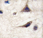IHC analysis of FFPE human brain tissue stained with anti-TAU antibody