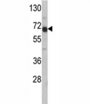 AFP Antibody HepG2 WB. Western blot analysis of AFP antibody and HepG2 lysate. Predicted molecular weight: ~70 kDa.