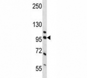 Western blot analysis of NCL and human placenta tissue lysate. Predicted molecular weight is 77 kDa, observed size is 100~110 kDa.