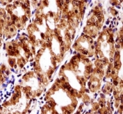 PAX7 antibody immunohistochemistry analysis in formalin fixed and paraffin embedded human stomach tissue