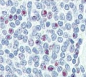 IHC analysis of FFPE human spleen tissue stained with NANOG antibody