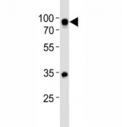 Western blot analysis of lysate from Ramos cell line using CD19 antibody at 1:500.  Expected size is 60~100 kDa depending on glycosylation level.