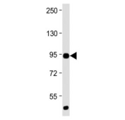 Western blot analysis of mouse heart tissue lysate with anti-TLR2 antibody. Predicted molecular weight: 85-90 kDa.