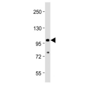 Western blot analysis of mouse heart tissue lysate with anti-TLR2 antibody. Predicted molecular weight: 85-90 kDa.