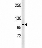 LOXL2 antibody western blot analysis in A549 lysate. Predicted molecular weight ~87 kDa.