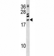 ATF3 antibody western blot analysis in CEM lysate.  Predicted size: 21-28 kDa