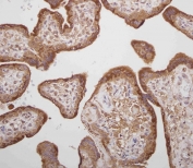 IHC staining of FFPE human placenta with Prolactin antibody. HIER: boil tissue sections in pH6, 10mM citrate buffer, for 10-20 min and allow to cool before testing.