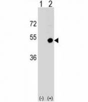 CD1d Antibody Rabbit Polyclonal used in western blot with 293 cell lysate (2 ug/lane) either non-transfected (Lane 1) or transiently transfected (2) with the CD1D gene.
