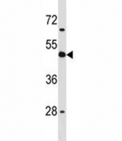 CD1d antibody western blot analysis in human K562 cell lysate.