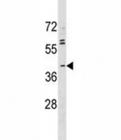 ABO antibody western blot analysis in MDA-MB231 lysate