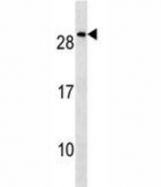 NKX2.8 Antibody A549 WB. Western blot analysis of human A549 cell lysate using NKX2.8 Antibody detects a band at approximately 28 kDa, consistent with the expected molecular weight range of NKX2.8 / NK2 homeobox 8. This NK2 homeobox protein antibody supports characterization of developmental transcription factor signaling and lineage-associated regulatory pathways in epithelial-derived tumor cells.
