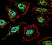 TFE3 Antibody for IF. Immunofluorescence analysis of TFE3 (Transcription factor E3) in human HeLa cells using TFE3 Antibody for IF shows green fluorescent signal corresponding to TFE3 protein localization. Cells were fixed with 4 percent PFA for 20 minutes, permeabilized with 0.1 percent Triton X-100 for 10 minutes, and incubated with primary antibody for 1 hour at 37oC. Alexa Fluor 488 conjugated donkey anti-rabbit secondary antibody was used to detect TFE3 signal (green). Cytoplasmic actin was counterstained with Alexa Fluor 555 conjugated phalloidin (red), and nuclei were stained with DAPI (blue). Fluorescent signal is observed in both nuclear and cytoplasmic compartments of HeLa cells, consistent with the dynamic intracellular localization of TFE3 during transcriptional regulation and metabolic signaling.