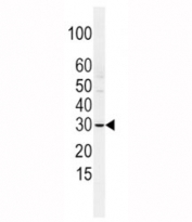 Western blot analysis of SLUG antibody and HCSMC lysate. Predicted molecular weight ~ 30 kDa.