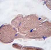 Myostatin Antibody Skeletal Muscle IHC. Immunohistochemistry analysis of FFPE human skeletal muscle tissue stained with Myostatin Antibody / Muscle Growth Regulator Antibody demonstrates diffuse cytoplasmic HRP-DAB brown staining throughout skeletal myofibers. The staining pattern is consistent with expression of Myostatin (MSTN), also known as Growth Differentiation Factor 8 (GDF8), a member of the TGF-beta superfamily that functions as a key negative regulator of skeletal muscle growth and differentiation. Widespread immunoreactivity within muscle fibers supports the established role of Myostatin in regulating muscle mass, myofiber homeostasis, tissue remodeling, and myogenic signaling pathways. The observed staining demonstrates the utility of this antibody for studies of skeletal muscle biology, muscle growth regulation, regenerative processes, and muscle-related disease mechanisms.