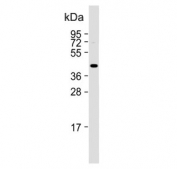 Myostatin Antibody Skeletal Muscle WB. Western blot analysis of human skeletal muscle tissue lysate using Myostatin Antibody / Muscle Growth Regulator Antibody demonstrates a distinct immunoreactive band at approximately 43 kDa. The observed molecular weight is consistent with the predicted size of Myostatin (MSTN), also known as Growth Differentiation Factor 8 (GDF8), a member of the TGF-beta superfamily that functions as a key negative regulator of skeletal muscle growth and myogenic differentiation. Detection of the expected target in human skeletal muscle is consistent with the established role of Myostatin in regulating muscle mass, myofiber homeostasis, tissue remodeling, and muscle growth signaling pathways. The observed immunoreactivity supports the use of this antibody for studies of skeletal muscle biology, myogenesis, regenerative processes, and muscle-related disease mechanisms.