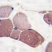 IHC analysis of FFPE human skeletal muscle tissue stained with UCHL3 antibody