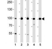 EZH2 Antibody Immunoblot. Western blot analysis of lysate from (1) MDA-MB-468, (2) SW620, (3) T47D cell line, (4) mouse spleen, (5) mouse testis tissue using EZH2 antibody at 1:1000. Predicted molecular weight: 85-95 kDa.